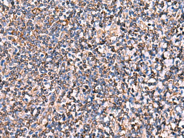 INSC Polyclonal Antibody (E-AB-18117)