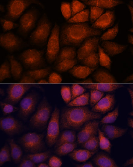 KIF13A Polyclonal Antibody (E-AB-66611)