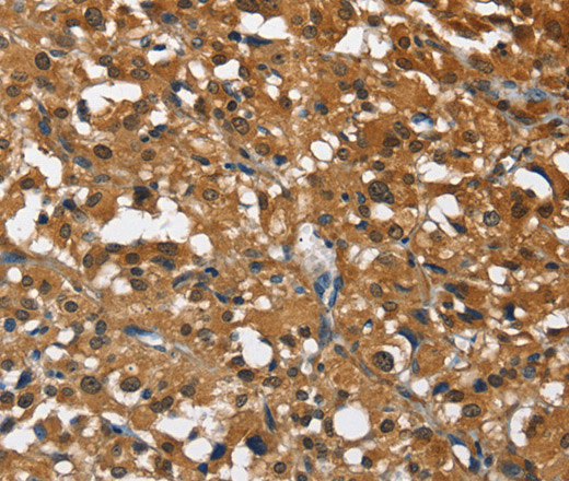 DRAK2 Polyclonal Antibody (E-AB-14744)