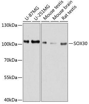 SOX30 Polyclonal Antibody (E-AB-63588)