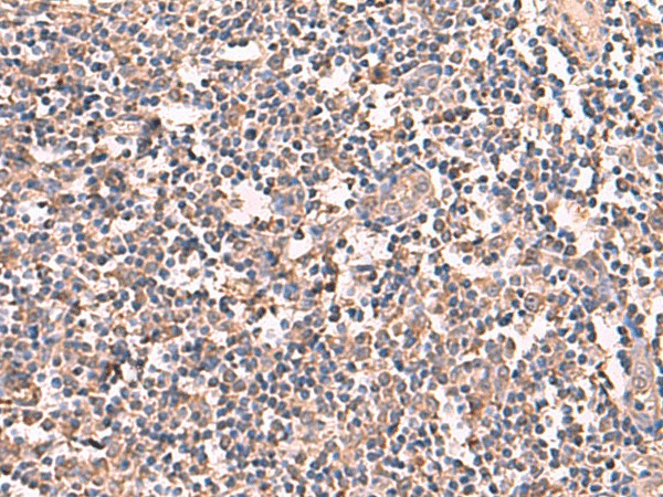 RIOK1 Polyclonal Antibody (E-AB-52988)