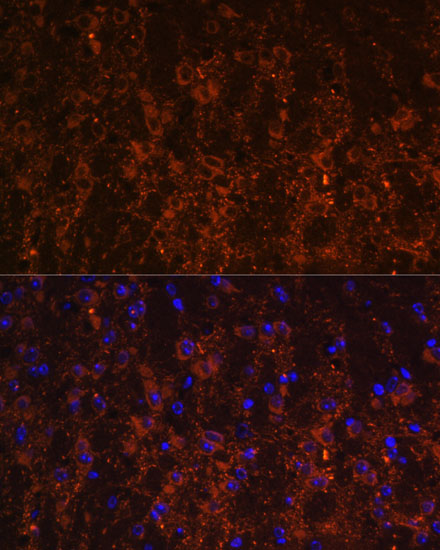 SNX13 Polyclonal Antibody (E-AB-64338)