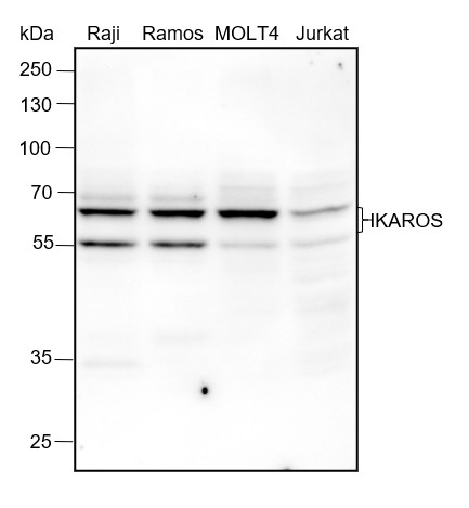 Recombinant IKAROS Monoclonal Antibody (AN301562L)