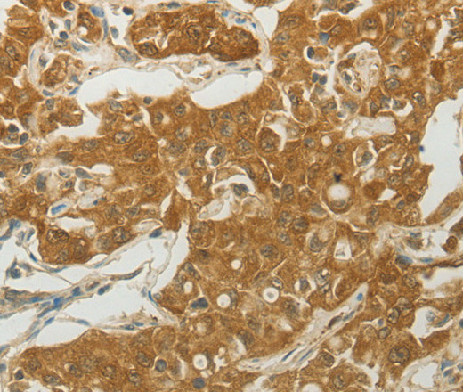 MC4R Polyclonal Antibody (E-AB-15766)