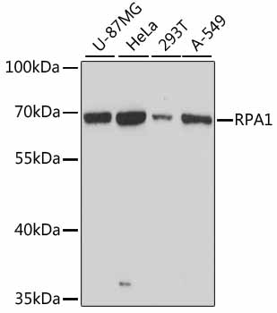 RPA1 Polyclonal Antibody (E-AB-64035)