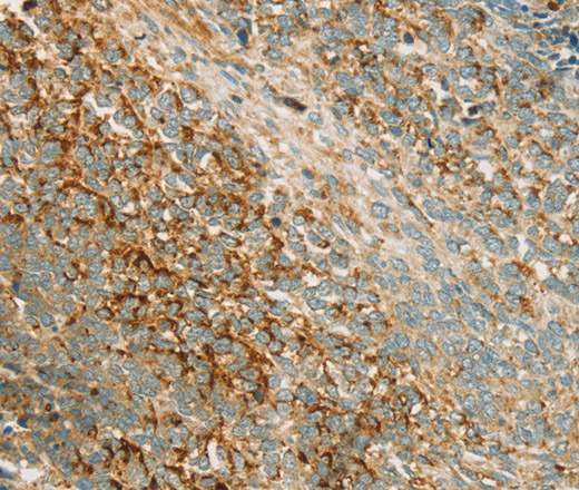 AMPK alpha1 Polyclonal Antibody (E-AB-12968)