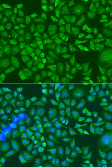 IGF2BP2 Polyclonal Antibody (E-AB-64927)