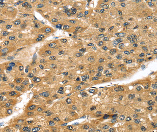 STX8 Polyclonal Antibody (E-AB-15430)