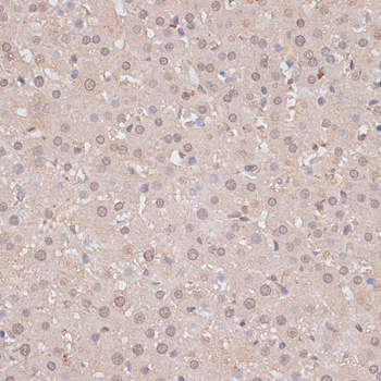 HSF1 Polyclonal Antibody (E-AB-64819)
