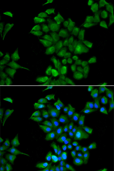 CTNS Polyclonal Antibody (E-AB-61386)