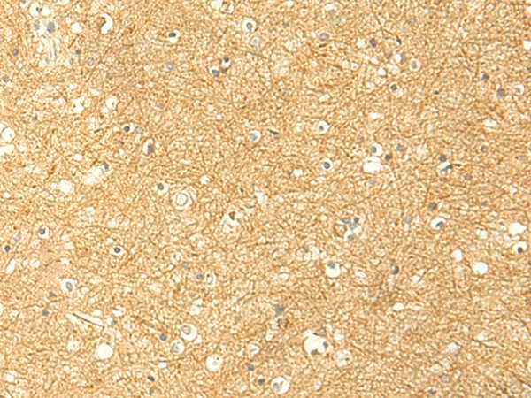 RNF148 Polyclonal Antibody (E-AB-18965)