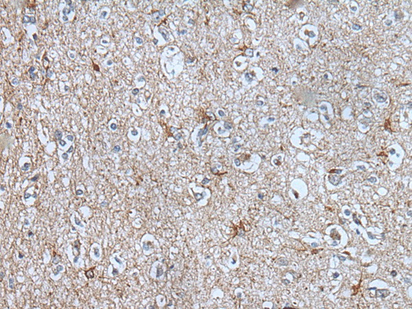 BMP1 Polyclonal Antibody (E-AB-53602)