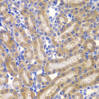 SHC1 Polyclonal Antibody (E-AB-62212)