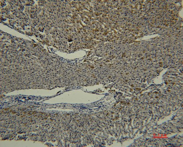 Transferrin Monoclonal Antibody (E-AB-22186)