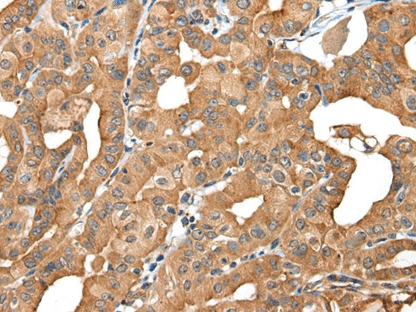 INF2 Polyclonal Antibody (E-AB-18555)
