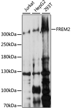 FREM2 Polyclonal Antibody (E-AB-91389)