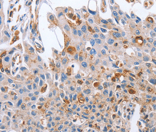 NRG4 Polyclonal Antibody (E-AB-14669)
