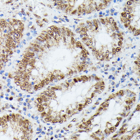 KIF22 Polyclonal Antibody (E-AB-65250)