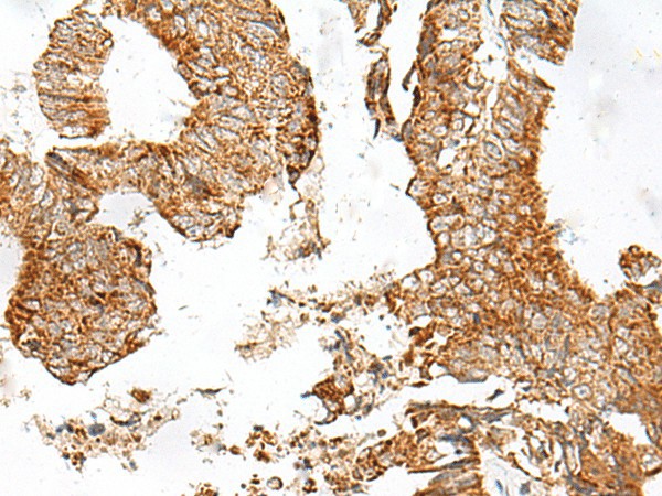 GPR119 Polyclonal Antibody (E-AB-19928)
