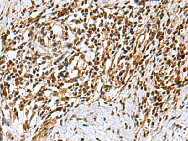 KDM2B Polyclonal Antibody (E-AB-52090)