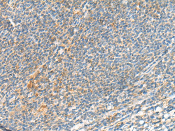 TSHB Polyclonal Antibody (E-AB-19862)