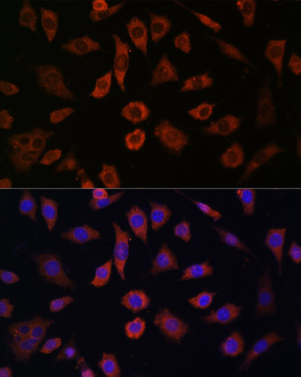 CYTH1 Polyclonal Antibody (E-AB-65277)