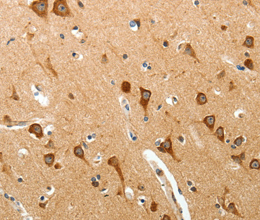 BIRC6 Polyclonal Antibody (E-AB-16082)