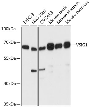 VSIG1 Polyclonal Antibody (E-AB-64850)