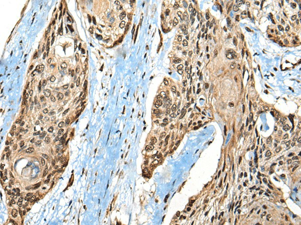 CASK Polyclonal Antibody (E-AB-52518)