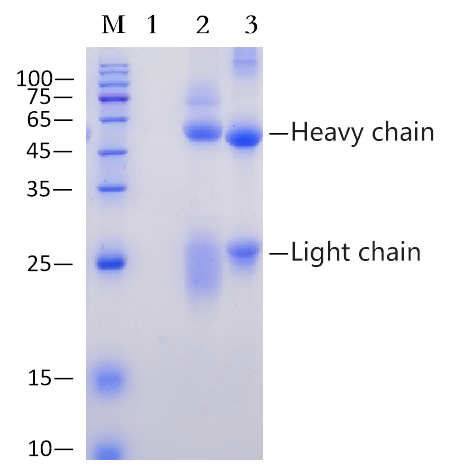 Protein A/G Magnetic Beads (EA-IP-007M)