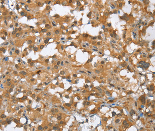 MMP12 Polyclonal Antibody (E-AB-14217)