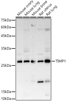 TIMP1 Polyclonal Antibody (E-AB-66160)