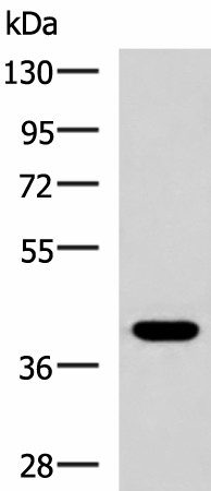 PLPPR5 Polyclonal Antibody (E-AB-53287)