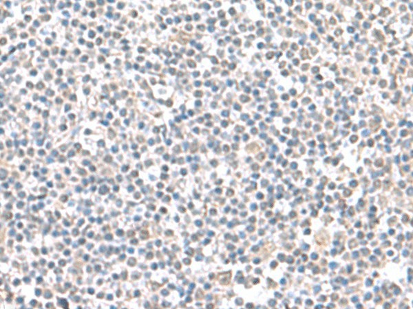 IFI27 Polyclonal Antibody (E-AB-19105)
