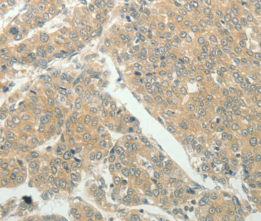SLC8A3 Polyclonal Antibody (E-AB-15997)