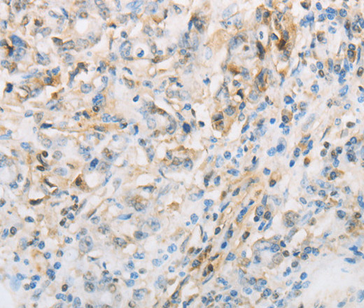 NPPC Polyclonal Antibody (E-AB-16009)