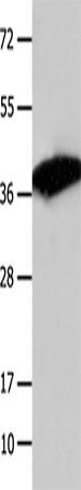 COPS5 Polyclonal Antibody (E-AB-10415)