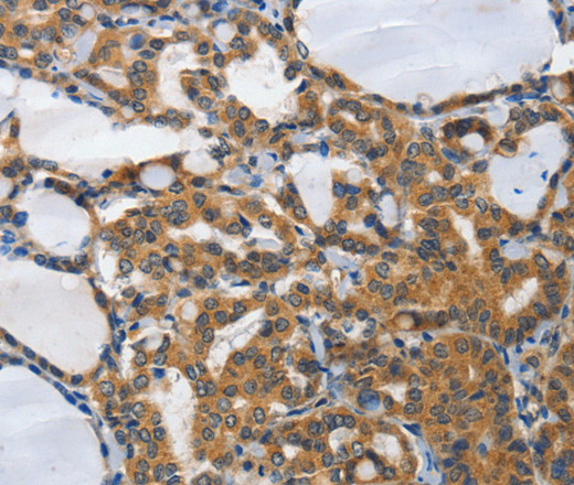 PIAS2 Polyclonal Antibody (E-AB-13005)
