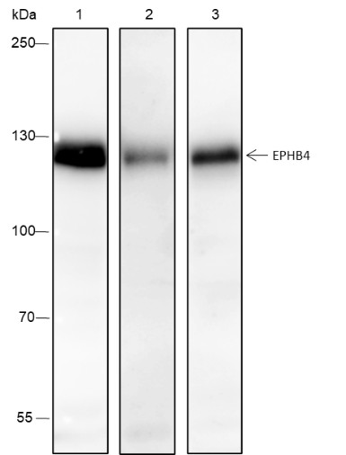 Recombinant EPHB4 Monoclonal Antibody (AN301515L)