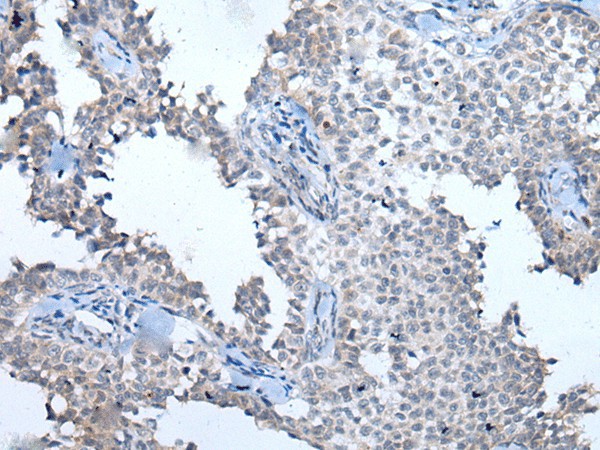 ATM Polyclonal Antibody (E-AB-19625)