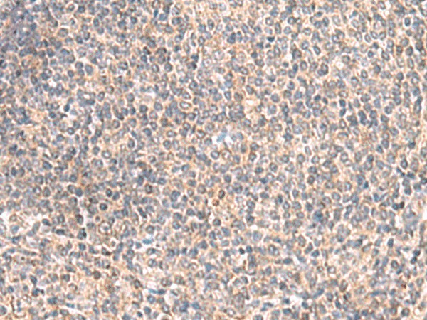 GIMAP2 Polyclonal Antibody (E-AB-18987)