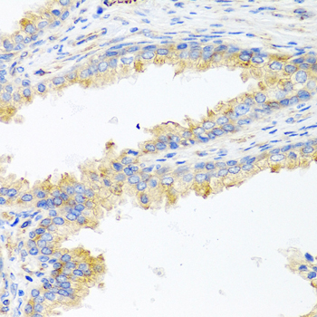 APOE Polyclonal Antibody (E-AB-62006)