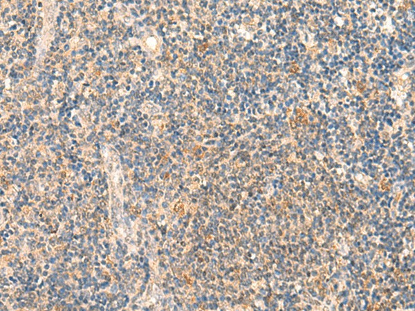 HSPA4L Polyclonal Antibody (E-AB-52003)