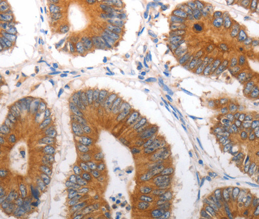 SLC12A6 Polyclonal Antibody (E-AB-12640)