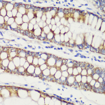 (KO Validated) TOM20 Polyclonal Antibody (E-AB-66977)