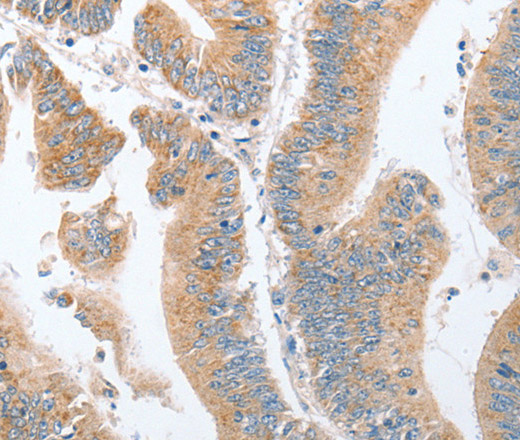 PARD6A Polyclonal Antibody (E-AB-10525)