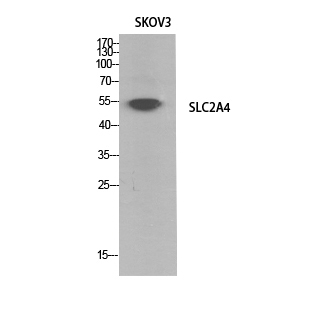 GLUT-4 Polyclonal Antibody (E-AB-30268)