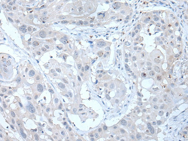 ANGPTL6 Polyclonal Antibody (E-AB-53514)