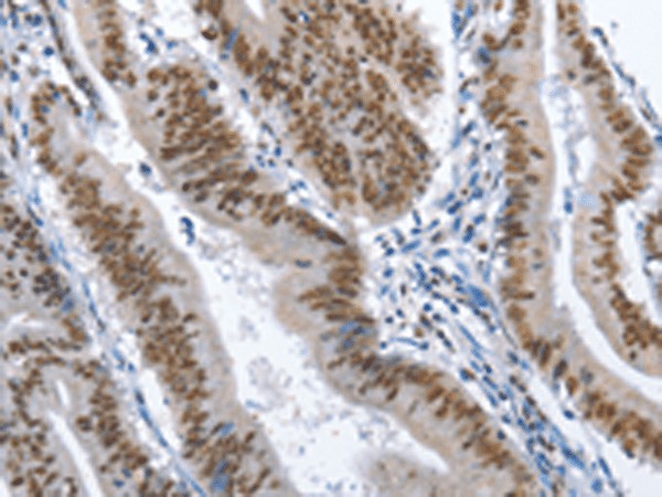 GNRH1 Polyclonal Antibody (E-AB-52158)