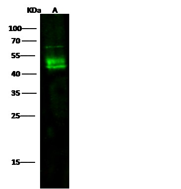 Recombinant DC-SIGN/CD209 Monoclonal Antibody (AN300179P)